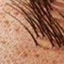Epilare definitiva cu laser